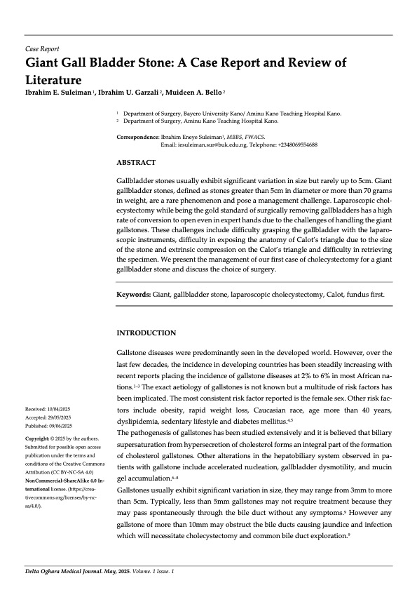 Giant Gall Bladder Stone: A Case Report and Review of  Literature  